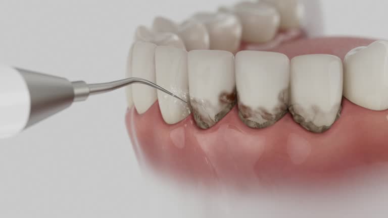 Trusted Invisalign Clear Aligners service in Oakdale, LA - Dentist Open Now